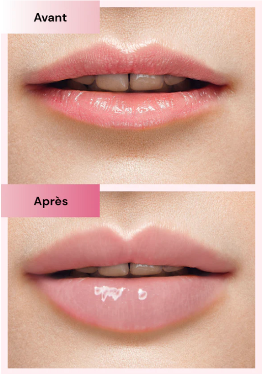 Témoignages d'Utilisateurs Heureux