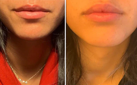 Les Avantages Inattendus de VoluLips